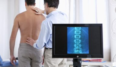 Biopsy-driven treatment strategy improves clinical outcomes in psoriatic arthritis