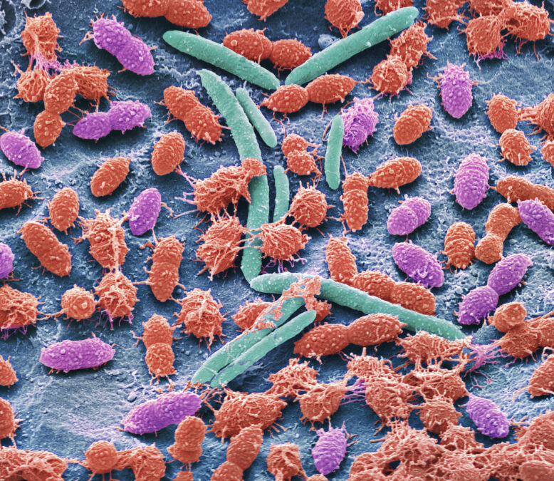 Common Drugs Can Rewire Your Gut For Several Years, Study Finds