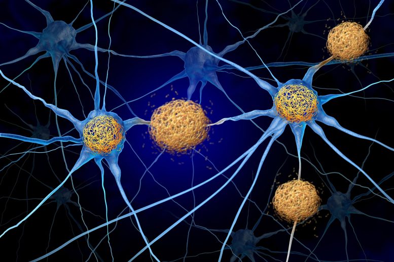 Tau Tangles Amyloid Beta Neuron Cells Brain Alzheimers Dementia