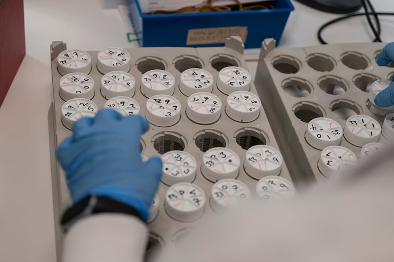 Test samples at the new National Cervical Screening Laboratory on the Coombe Hospital campus. Photograph: Paulo Nunes dos Santos