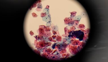 Inside Ireland’s cervical cancer test lab: A new start for screening after smear-test controversies – The Irish Times