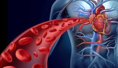 Daytime Sleepiness, Difficulty Falling Asleep Tied to Hypertension