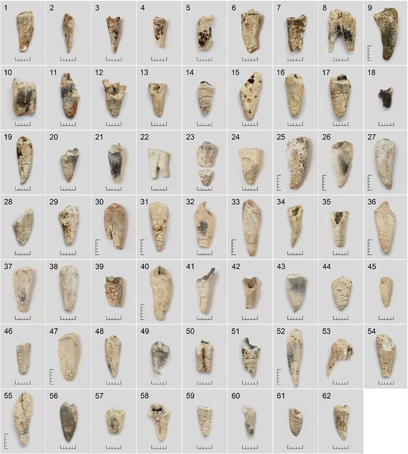Bronze Age cremated teeth help researchers estimate age at death, study finds