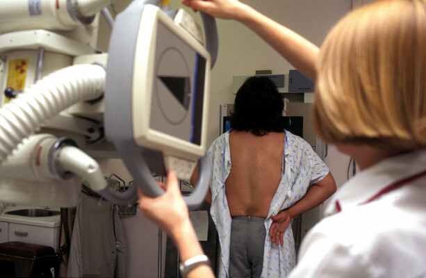 Irish researchers find AI can help determine if breast cancer patients need chemotherapy