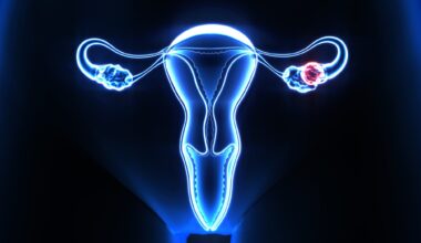 X-ray view showing human female reproductive system with focus on uterus and an ovarian cyst in blue and red colors