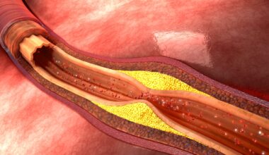 New Blood Test Method Improves HDL Function Analysis in Heart Disease