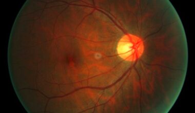 First Human Receives Experimental Therapy to Reverse Cellular Aging