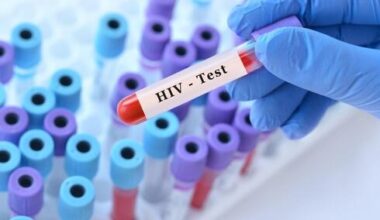 Israel’s HIV fight falters as at least 1 in 10 carriers may not know they are infecte