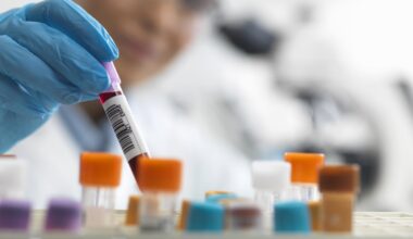 Ireland unlikely to end HIV transmission by 2030