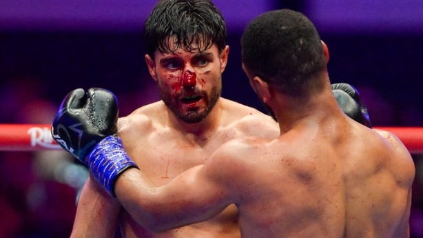 JEDDAH, SAUDI ARABIA - JULY 25: Josh Kelly (white and red shorts) looks on at Caoimhin Agyarko (black, green and orange shorts) during the IBF World Super Welterweight title fight between Josh Kelly and Caoimhin Agyarko in the Anthony Joshua v Kristian Prenga: The Comeback fight night at Jeddah Supe