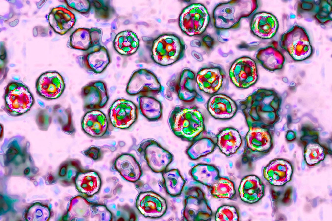 Amid Cyclosporiasis Outbreak, Measles Cases Are Nearing Last Year's Total