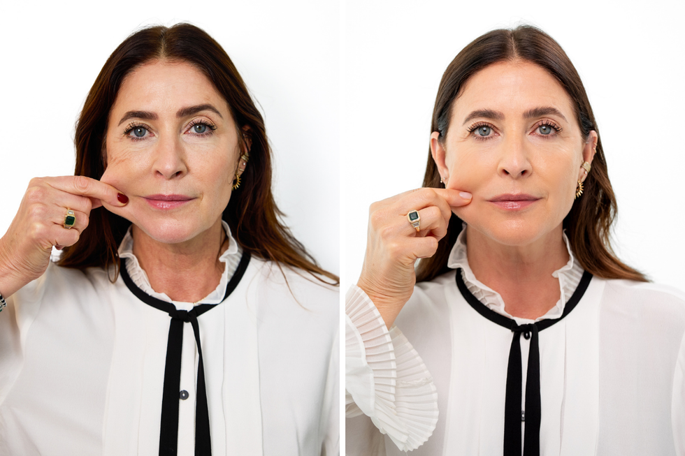 lisa snowdon sculptra