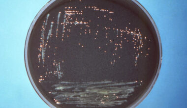 Cases of Legionnaires’ Disease on Manhattan’s Upper East Side jumps to 10: NYC health officials