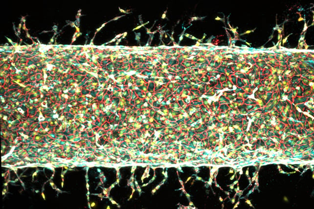 Artificial blood vessel