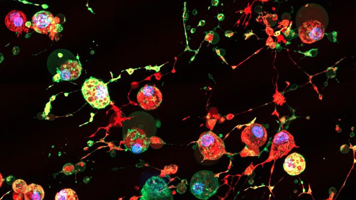 Newly Discovered 'Footprint of Death' May Help Viruses Spread : ScienceAlert