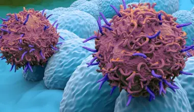 endometrial cancer