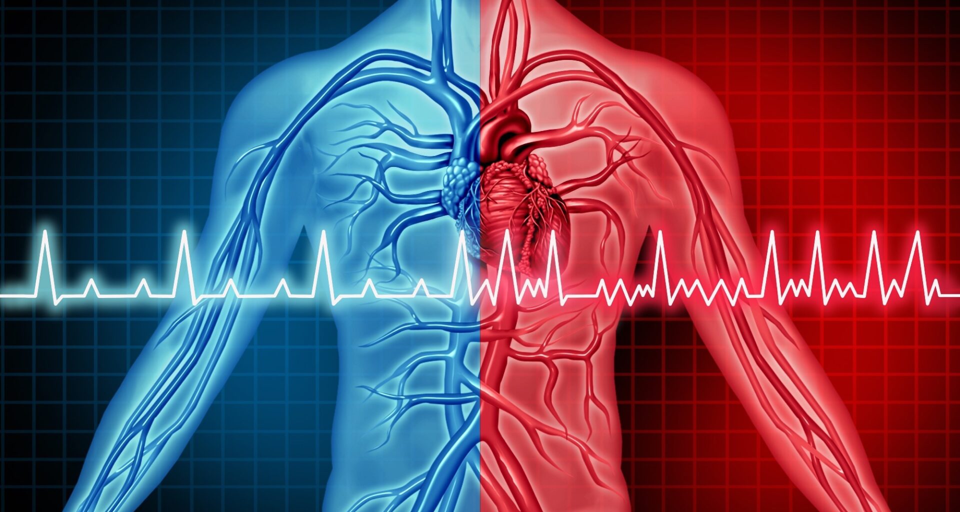 A common dietary nutrient feeds a gut pathway linked to atrial fibrillation