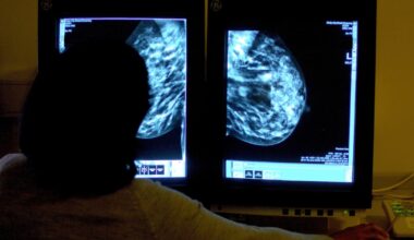 Overreliance on AI risks ‘deskilling’ health sector staff, report warns – The Irish Times