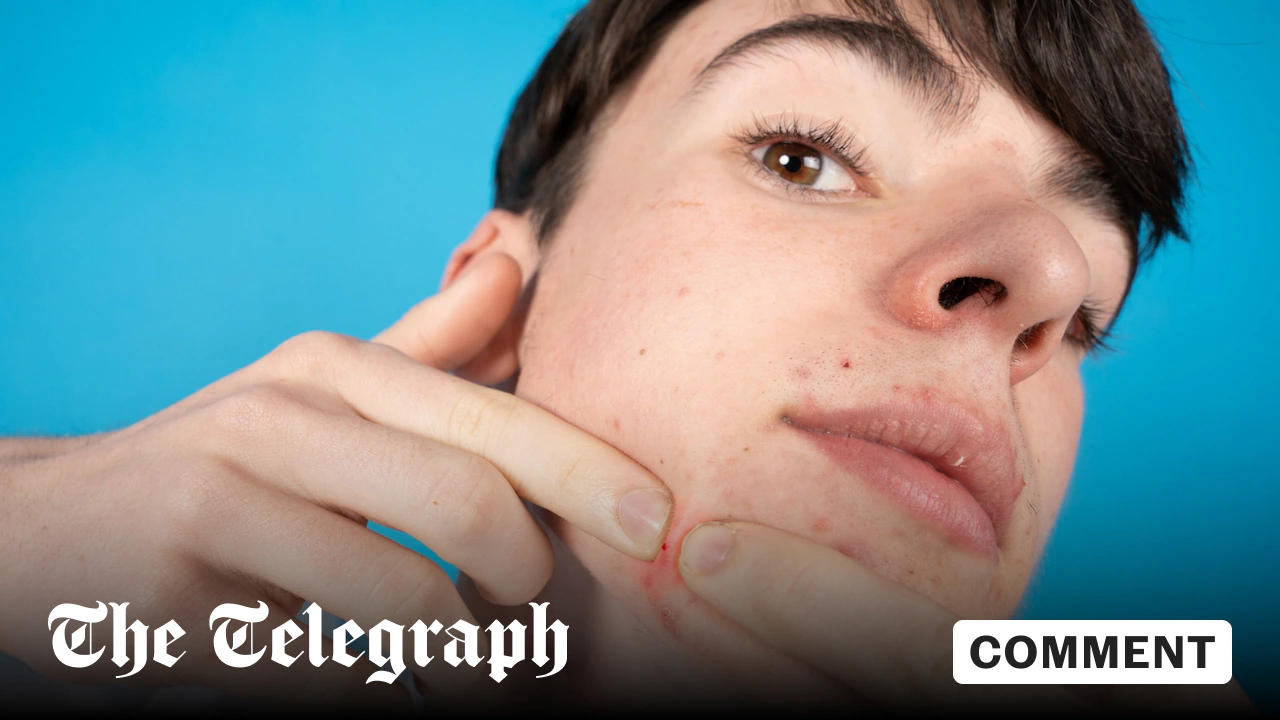 My son’s acne proves two-tier healthcare is already upon us