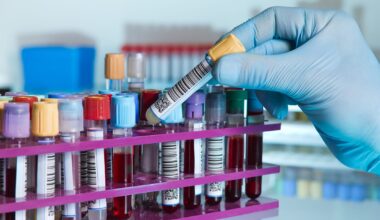 FDA Clears Diazyme Lipoprotein(a) Assay for Cardiovascular Risk Testing