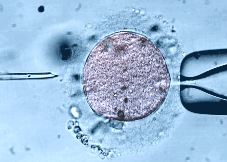 A light micrograph of a micro-needle (left) and pipette (right), with a purple-coloured human egg cell between them during IVF on a blue background