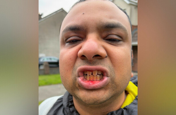 'He's from India': Man allegedly attacked by group of teens after they asked where he was from