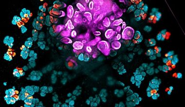 Kidney organoid [Lindstrom Lab/USC Stem Cell]