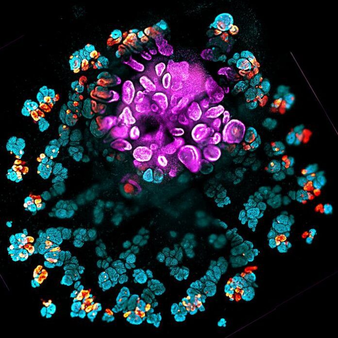 Kidney organoid [Lindstrom Lab/USC Stem Cell]