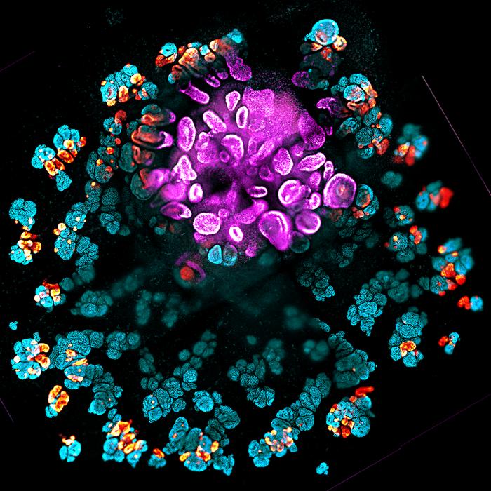 Kidney organoid [Lindstrom Lab/USC Stem Cell]