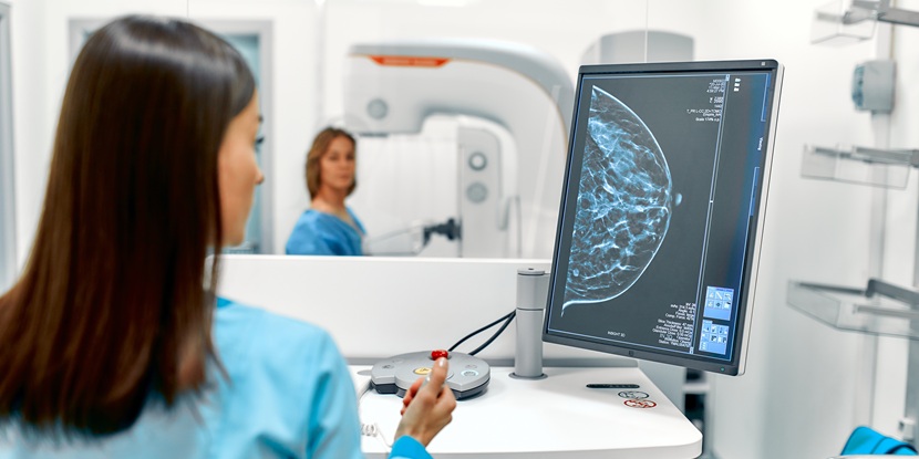 Hologic and Vossius take action against Siemens Healthineers over mammography system