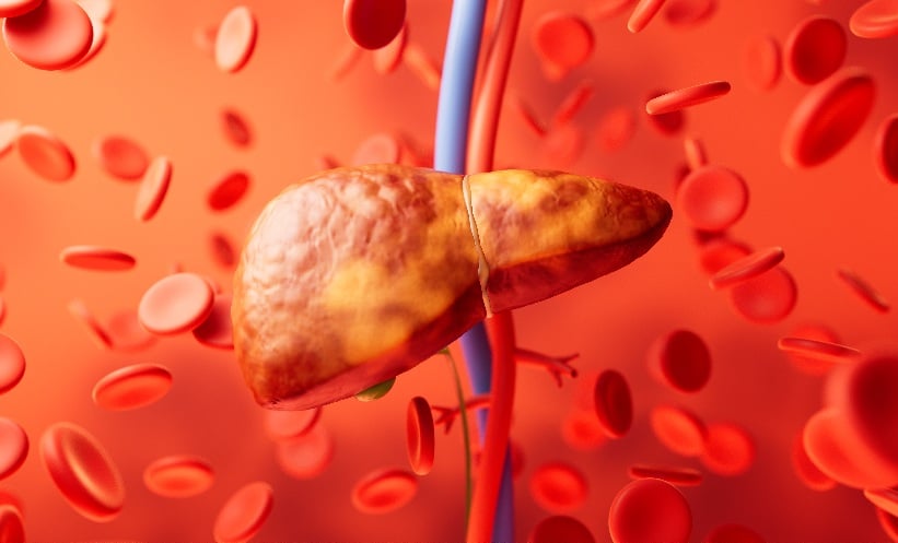 Steatotic Liver Disease: Why Dynamic Risk Matters