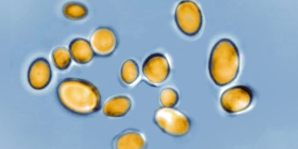 Deadly fungus rapidly spreading across the U.S.
