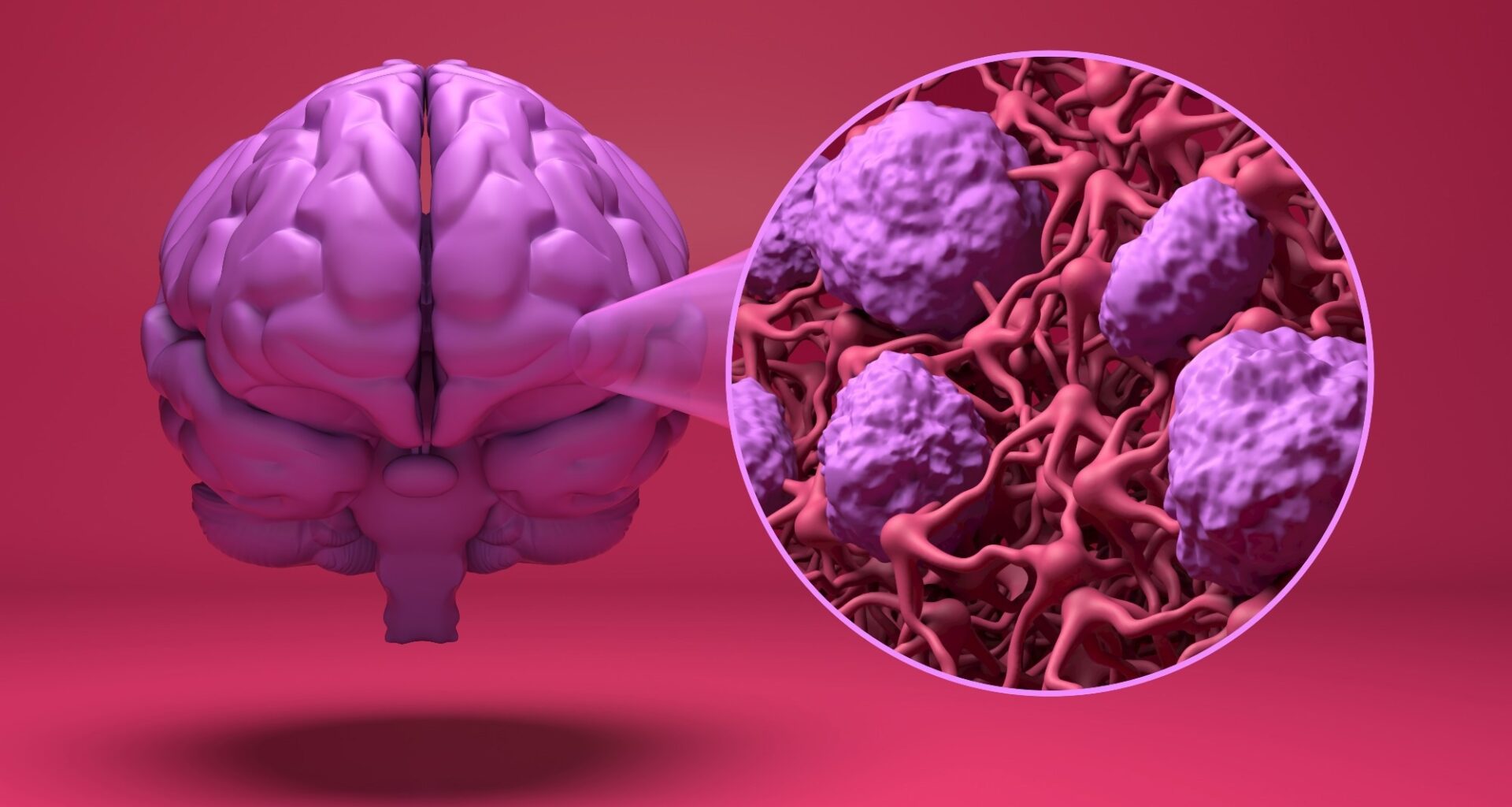 Study: Blood–brain barrier crossing of antihypertensives and risk of dementia: a comparative analysis. Image Credit: Nemes Laszlo / Shutterstock
