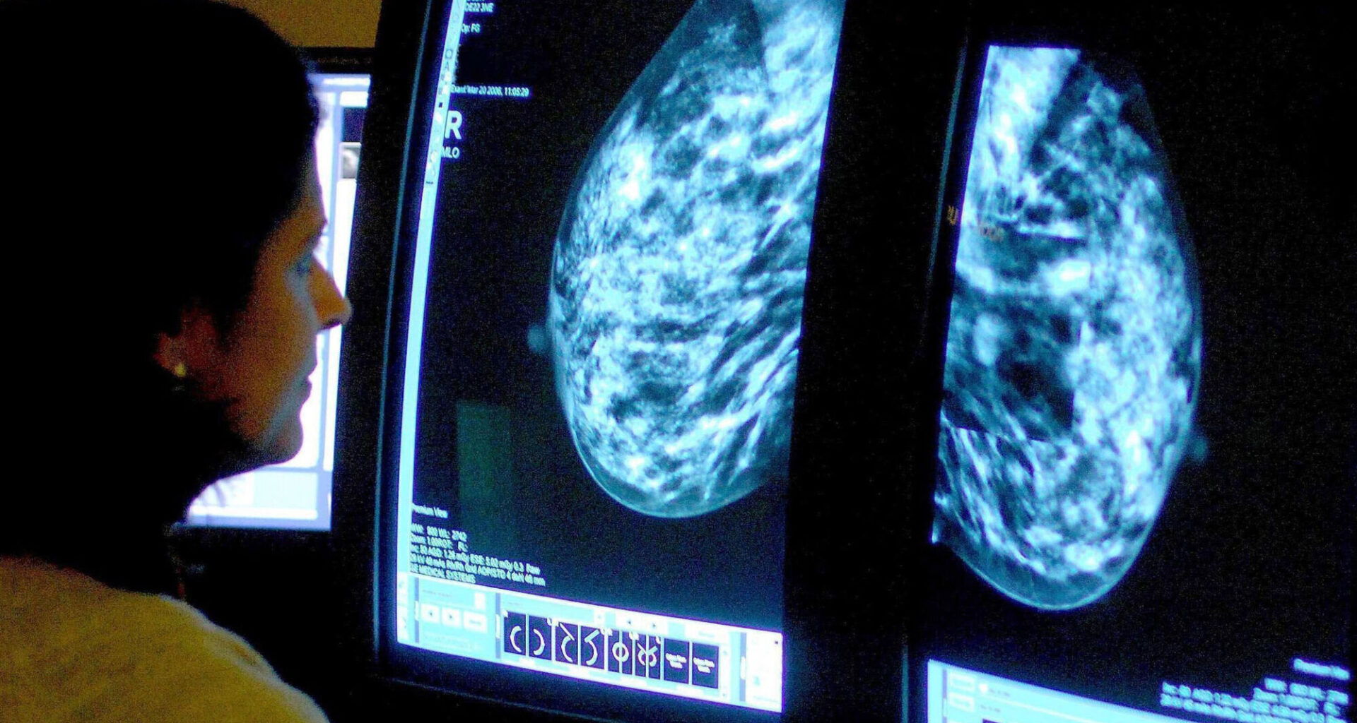Studying centrosomes, tiny structures that help divide DNA evenly when a cell makes a copy of itself, in tumour tissues has proved 'extremely challenging' because of their tiny size and constant changing. File photo: Rui Vieira/PA