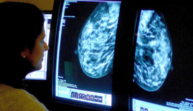 Studying centrosomes, tiny structures that help divide DNA evenly when a cell makes a copy of itself, in tumour tissues has proved 'extremely challenging' because of their tiny size and constant changing. File photo: Rui Vieira/PA