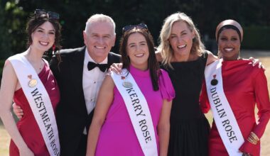 Rose of Tralee preparations: ‘I coincided embracing my hair loss with my decision not to wear fake tan’ – The Irish Times