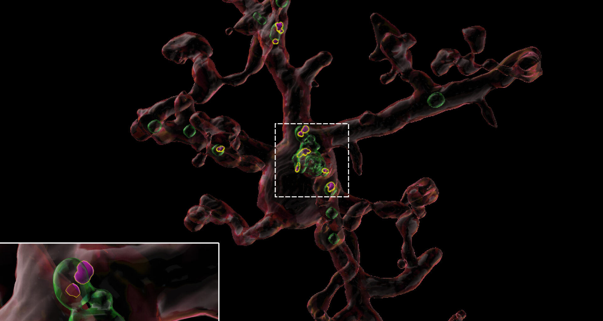 Youth-Associated Protein Helps Restore Healthy Function in Immune Cells in the Aging Brain