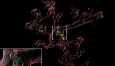 Youth-Associated Protein Helps Restore Healthy Function in Immune Cells in the Aging Brain