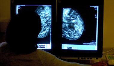 Almost 90% of urgent breast cancer referrals to Letterkenny not seen within target time – The Irish Times