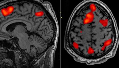 Two distinct types of brain tissue work together to support cognition in older adults