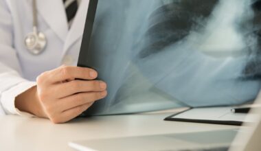 Radiologist who reviewed HSE patient scans had medical licence revoked in two countries – The Irish Times