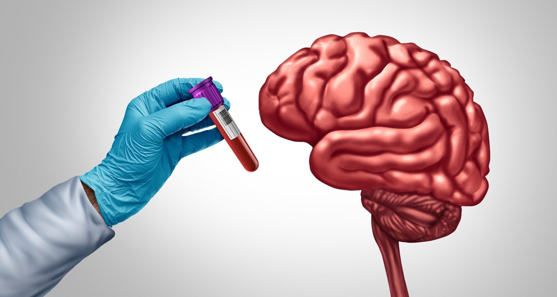 Study: Semaglutide attenuates a proteomics-based dementia risk signature in older adults with overweight or obesity and cardiovascular disease without diabetes: A post hoc analysis of the SELECT phase 3 trial. Image Credit: Lightspring / Shutterstock