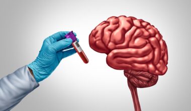 Study: Semaglutide attenuates a proteomics-based dementia risk signature in older adults with overweight or obesity and cardiovascular disease without diabetes: A post hoc analysis of the SELECT phase 3 trial. Image Credit: Lightspring / Shutterstock