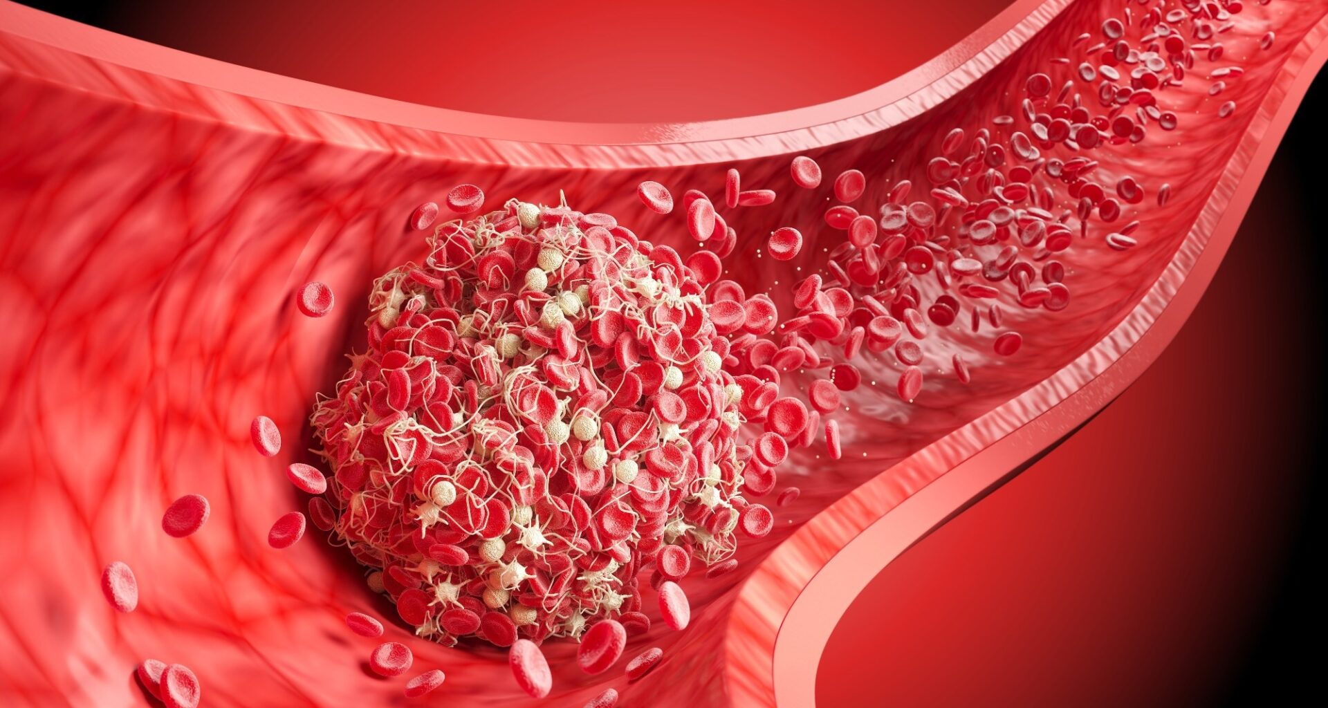 Study: Searching for biomarkers of long COVID: findings from a nationwide population-based study. Image Credit: Anusorn Nakdee / Shutterstock