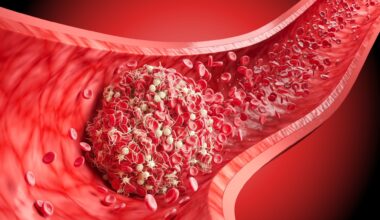 Study: Searching for biomarkers of long COVID: findings from a nationwide population-based study. Image Credit: Anusorn Nakdee / Shutterstock