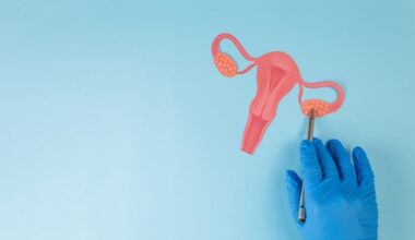 Omental Endothelium and Ovarian Cancer Growth