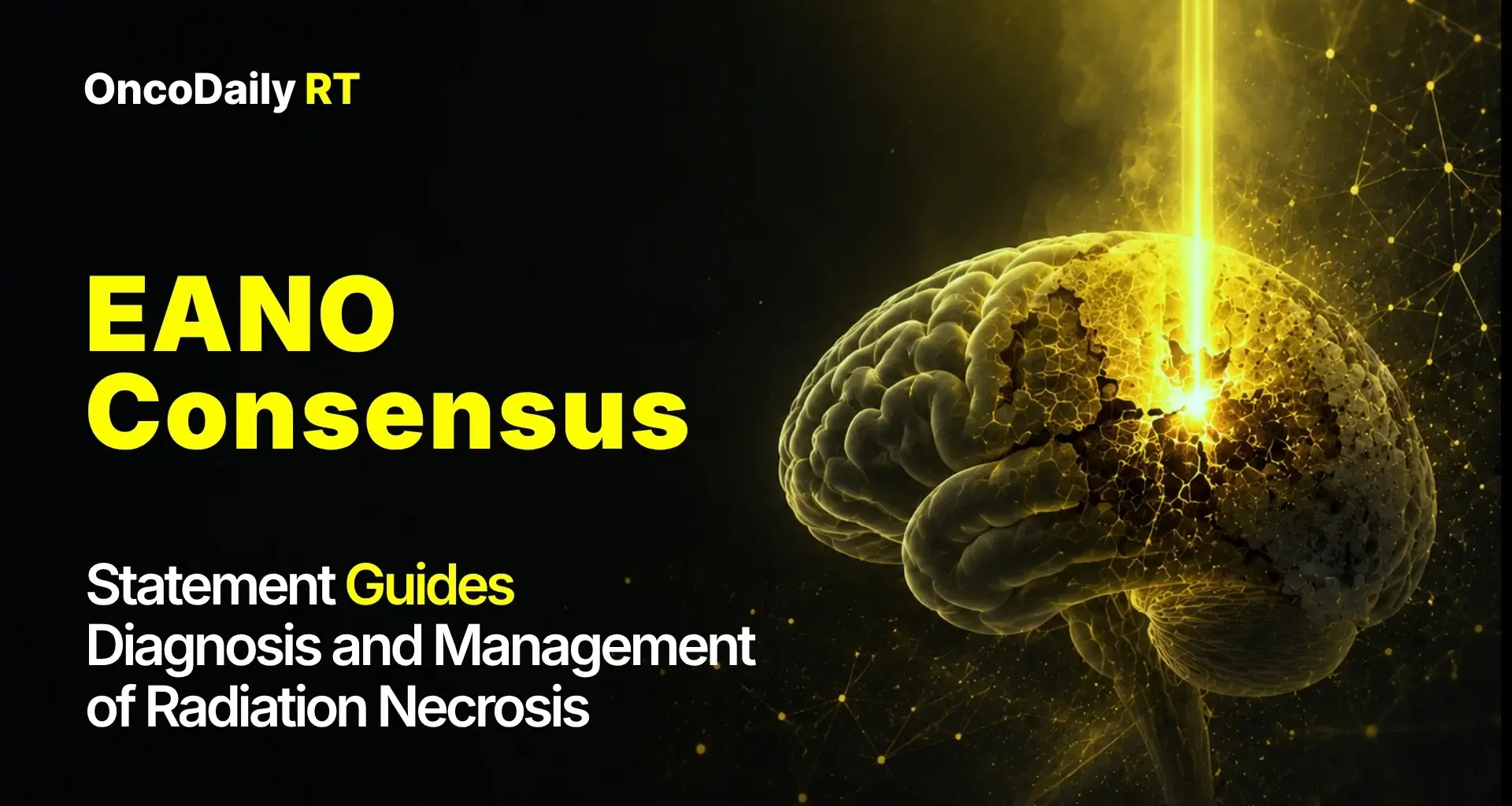 EANO Consensus Statement Guides Diagnosis and Management of Radiation Necrosis