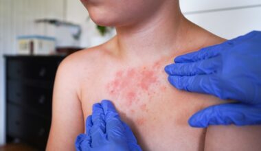 Child with red rash on chest being examined by doctor who wears blue latex gloves