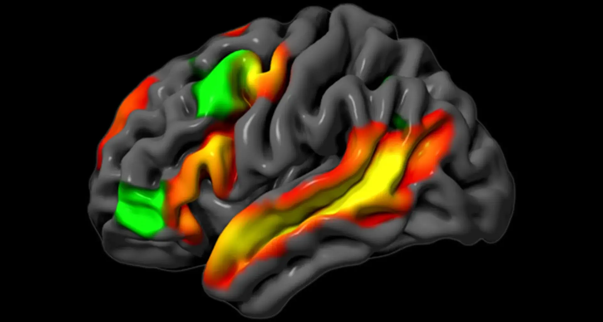 MIT neuroscientists discover the brain can reason without words