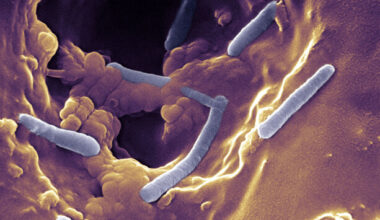 HSE managing outbreak of potentially serious infection at Limerick neonatal intensive care unit